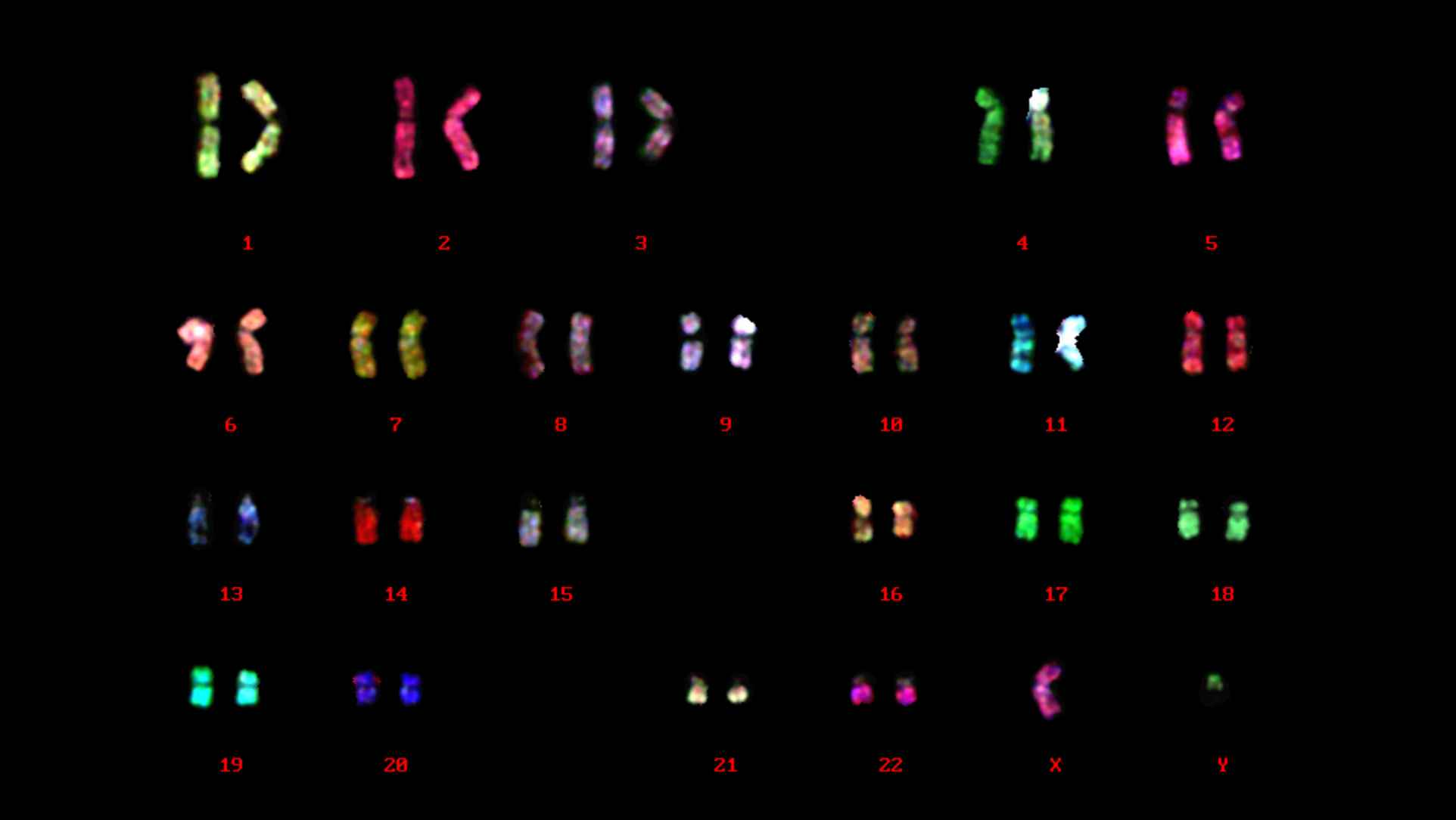 FISHの蛍光顕微鏡画像/有限会社クロモソームサイエンスラボ