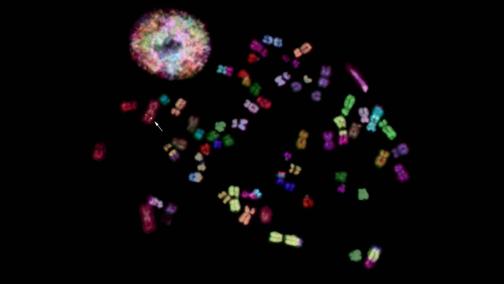 FISH細胞の蛍光顕微鏡画像/有限会社クロモソームサイエンスラボ