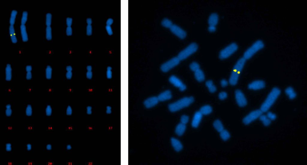CHO細胞でのFISHマッピングシグナル例／有限会社クロモソームサイエンスラボ
