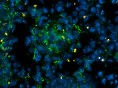 マウス腎臓での移植オス細胞のY-FISHとDesmin抗体での免疫染色／有限会社クロモソームサイエンスラボ