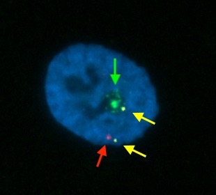 ヒトXX細胞でのRNA-FISH　HUWE1/XIST/UTX／有限会社クロモソームサイエンスラボ