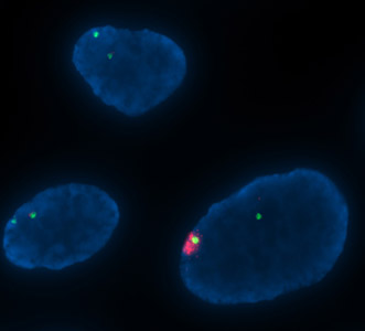 ヒトiPS細胞でのXISTの検出(DNA/RNA-FISH)／有限会社クロモソームサイエンスラボ