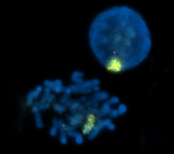 マウス細胞でのXISTの検出／有限会社クロモソームサイエンスラボ