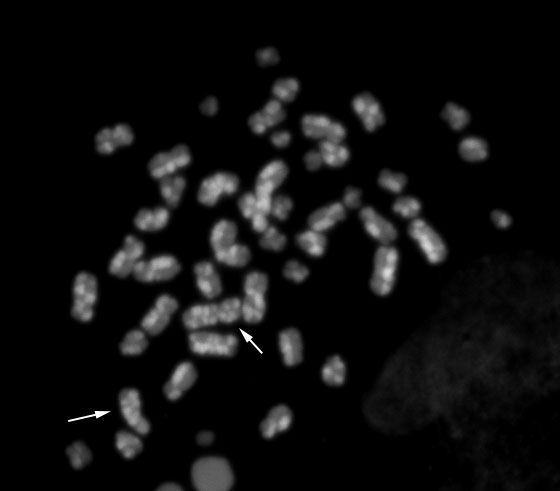 ヒトiPS細胞でのSCEの検出／有限会社クロモソームサイエンスラボ