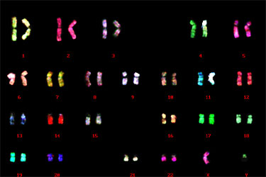 ヒトリンパ球より作成した染色体標本でのマルチカラーFISH解析／クロモソームサイエンスラボ