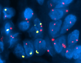 組織切片でのヒトＸＹ染色体FISHプローブ／有限会社クロモソームサイエンスラボ
