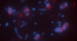 Anaerobic ammonium-oxidizing bacteria/微生物FISHプローブ/有限会社クロモソームサイエンスラボ