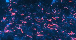 Gram-positive bacteria with low G+C//微生物FISHプローブ／有限会社クロモソームサイエンスラボ