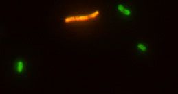 Salmonella spp., Plesiomonas shigelloides/微生物FISHプローブ/有限会社クロモソームサイエンスラボ