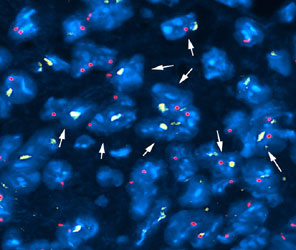 マウス心臓切片でのマウスXY染色体FISHプローブ／有限会社クロモソームサイエンスラボ